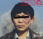 血管瘤病理图片图521-图540(图16)
