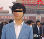 血管瘤病理图片图541-图560(图1)