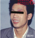 血管瘤病理图片图541-图560(图3)