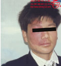 血管瘤病理图片图541-图560(图2)