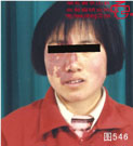 血管瘤病理图片图541-图560(图5)