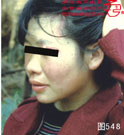 血管瘤病理图片图541-图560(图7)