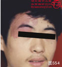 血管瘤病理图片图541-图560(图11)