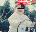 血管瘤病理图片图541-图560(图15)