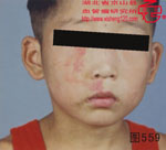 血管瘤病理图片图541-图560(图18)