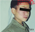 血管瘤病理图片图561-图580(图8)