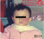 血管瘤病理图片图561-图580(图11)