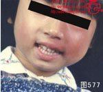 血管瘤病理图片图561-图580(图16)