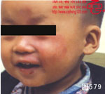 血管瘤病理图片图561-图580(图18)