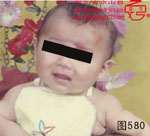 血管瘤病理图片图561-图580(图19)