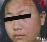 血管瘤病理图片图601-图620(图14)