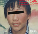 血管瘤病理图片图601-图620(图18)