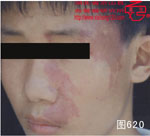 血管瘤病理图片图601-图620(图19)