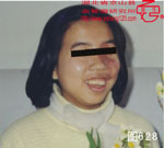 血管瘤病理图片图621-图640(图7)