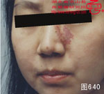 血管瘤病理图片图621-图640(图19)