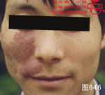 血管瘤病理图片图641-图660(图5)
