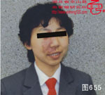 血管瘤病理图片图641-图660(图14)
