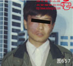 血管瘤病理图片图641-图660(图16)