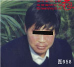 血管瘤病理图片图641-图660(图17)
