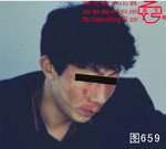 血管瘤病理图片图641-图660(图18)