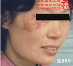 血管瘤病理图片图641-图660(图19)