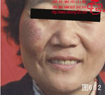 血管瘤病理图片图661-图680(图1)