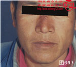 血管瘤病理图片图661-图680(图2)