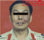 血管瘤病理图片图661-图680(图12)