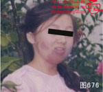 血管瘤病理图片图661-图680(图11)