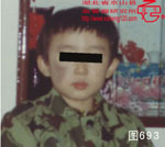 血管瘤病理图片图681-图700(图12)
