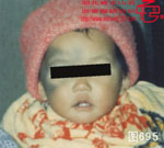 血管瘤病理图片图681-图700(图14)
