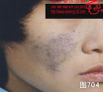 血管瘤病理图片图701-图720(图3)