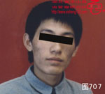 血管瘤病理图片图701-图720(图2)