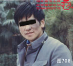 血管瘤病理图片图701-图720(图7)