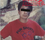 血管瘤病理图片图701-图720(图8)