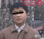 血管瘤病理图片图701-图720(图10)