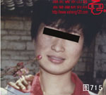 血管瘤病理图片图701-图720(图14)