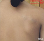血管瘤病理图片图701-图720(图18)