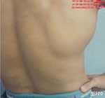 血管瘤病理图片图701-图720(图19)