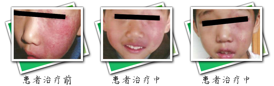 患者治疗前后对比(图3)