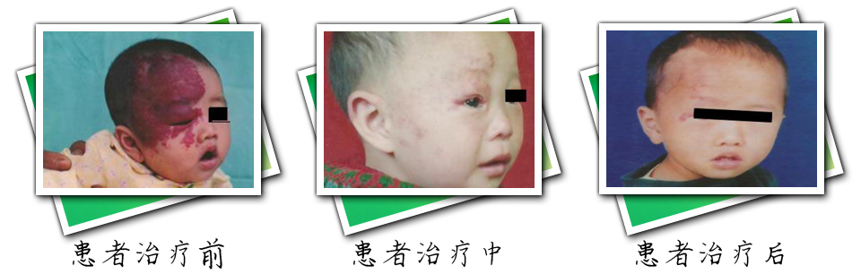 患者治疗前后对比(图4)