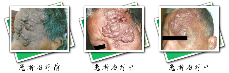 患者治疗前后对比(图5)