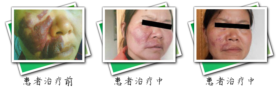 患者治疗前后对比(图6)
