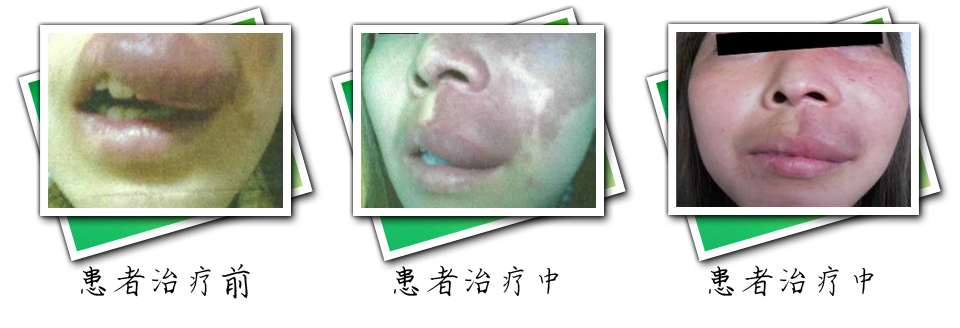 患者治疗前后对比(图7)